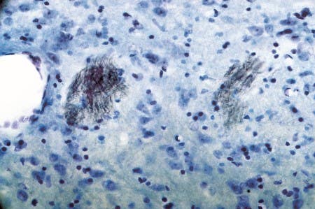 The Purinergic P2Y Receptors
