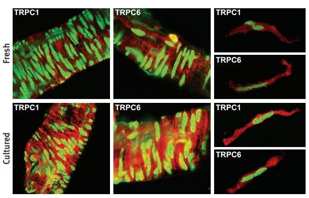 The Transient Receptor Potential Superfamily: Antibodies in Action