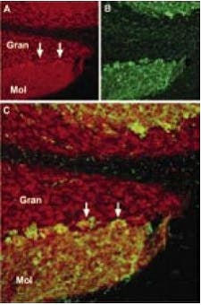 The Transient Receptor Potential (TRP) Ion Channels