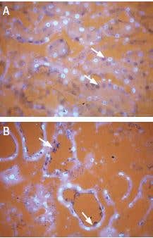 Contribution of Ion Channels in Pain Sensation