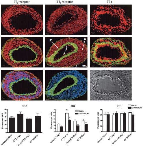 The Hype on the Endothelin Signaling System