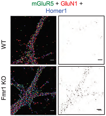 NMDA Receptor Dynamics Dictate Neuronal Plasticity and Function