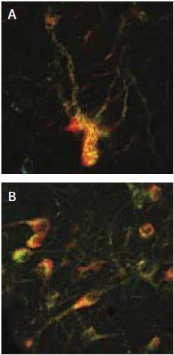 The Role of p75ᴺᵀᴿ in Cancer