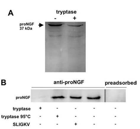pro-Neurotrophins: The Other Identity of Neurotrophins
