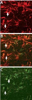 Live or Let Die in Neuroscience: The Story of the Proneurotrophins