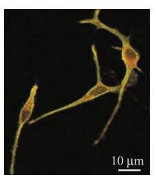 The Role of Ion Channels in Neurodegeneration