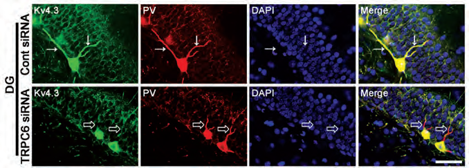 Kᵥ4 Channels Link Cognitive Decline and Cardiac Dysfunction During Aging