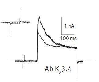 Ion Channels and Oxygen Sensing in the Carotid Body