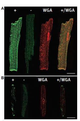 K⁺ Channels in Cardiomyocytes