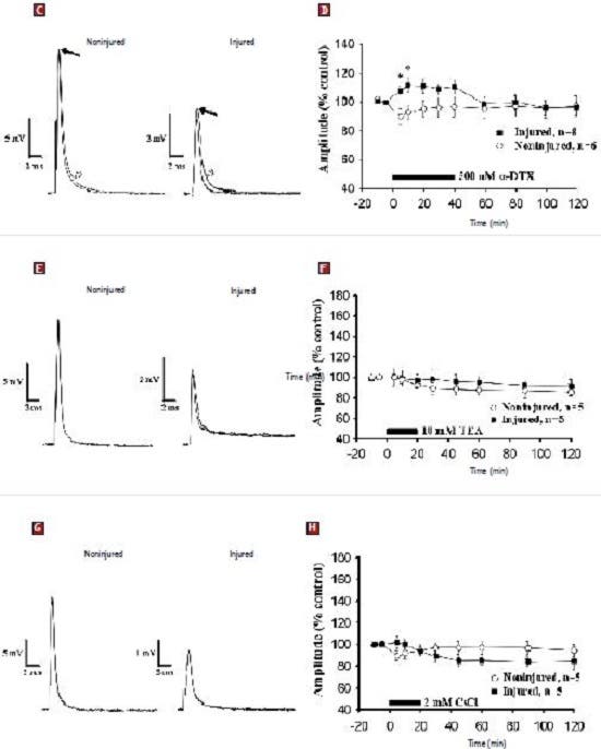 Role of Voltage-Gated K⁺ Channels in the Pathophysiology of Spinal Cord Injury