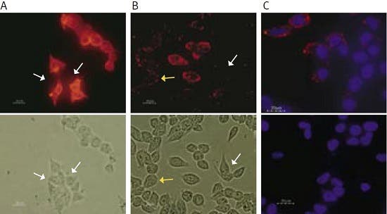 Targeting Ion Channels in Living Cells