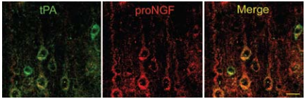 proNGF and proBDNF: The Alter Egos