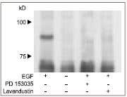 Ion Channels and Tyrosine Kinases