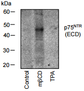 p75ᴺᵀᴿ &ndash; The Promiscuous Receptor