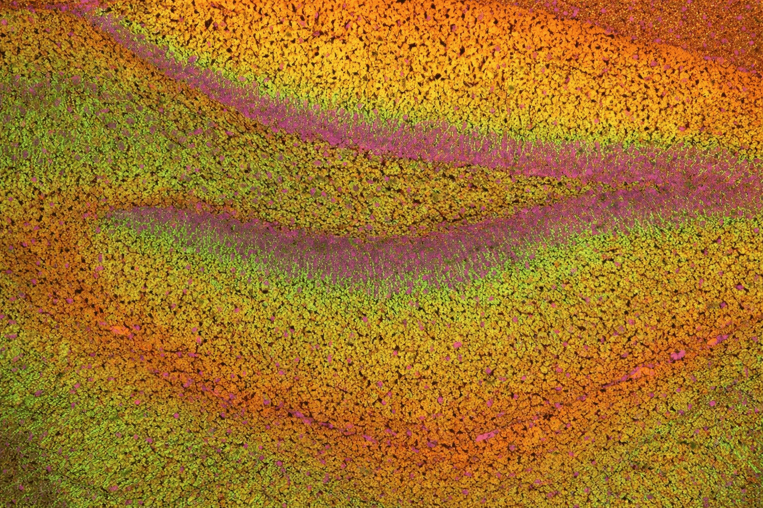 Multiplex Immunodetection