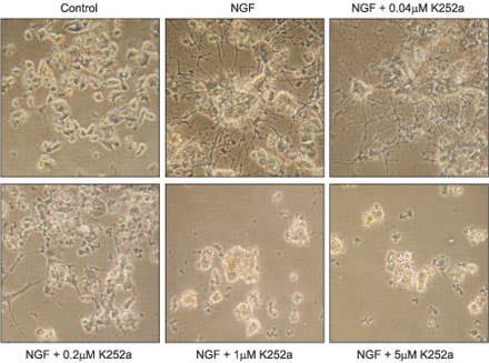 Protein Kinases