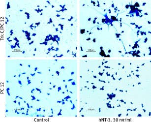 Neurotrophic Factors and Receptors