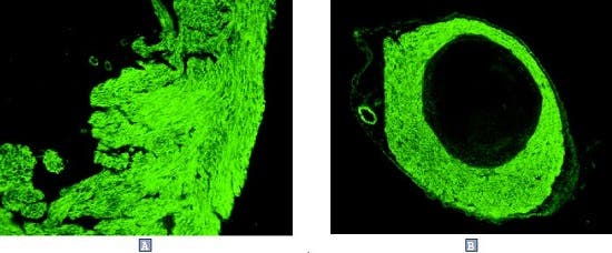 G-Protein Coupled Receptors