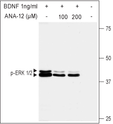 ANA-12