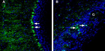 Anti-LRRC8A (extracellular) Antibody
