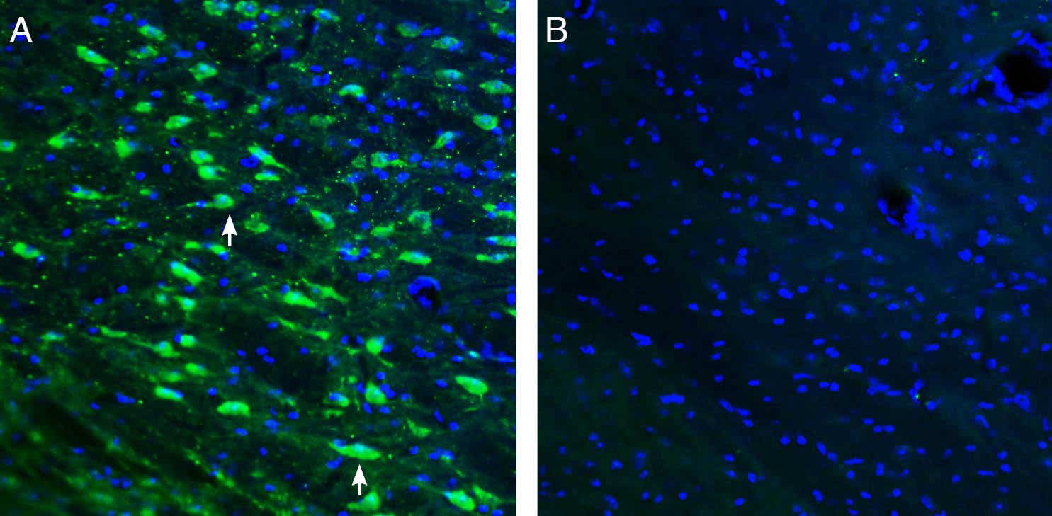 Anti-ACE2 (extracellular) Antibody - Carrier Free