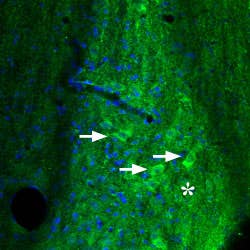 Anti-Adenosine A<sub>2A</sub> Receptor Antibody