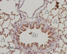 Anti-Adenosine A<sub>2B</sub> Receptor (extracellular) Antibody