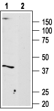 Adenosine A3 Receptor Blocking Peptide