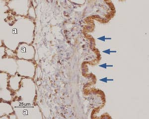 Anti-Adenosine A<sub>3</sub> Receptor Antibody