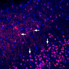 Anti-Adenosine A<sub>2A</sub> Receptor (extracellular) Antibody