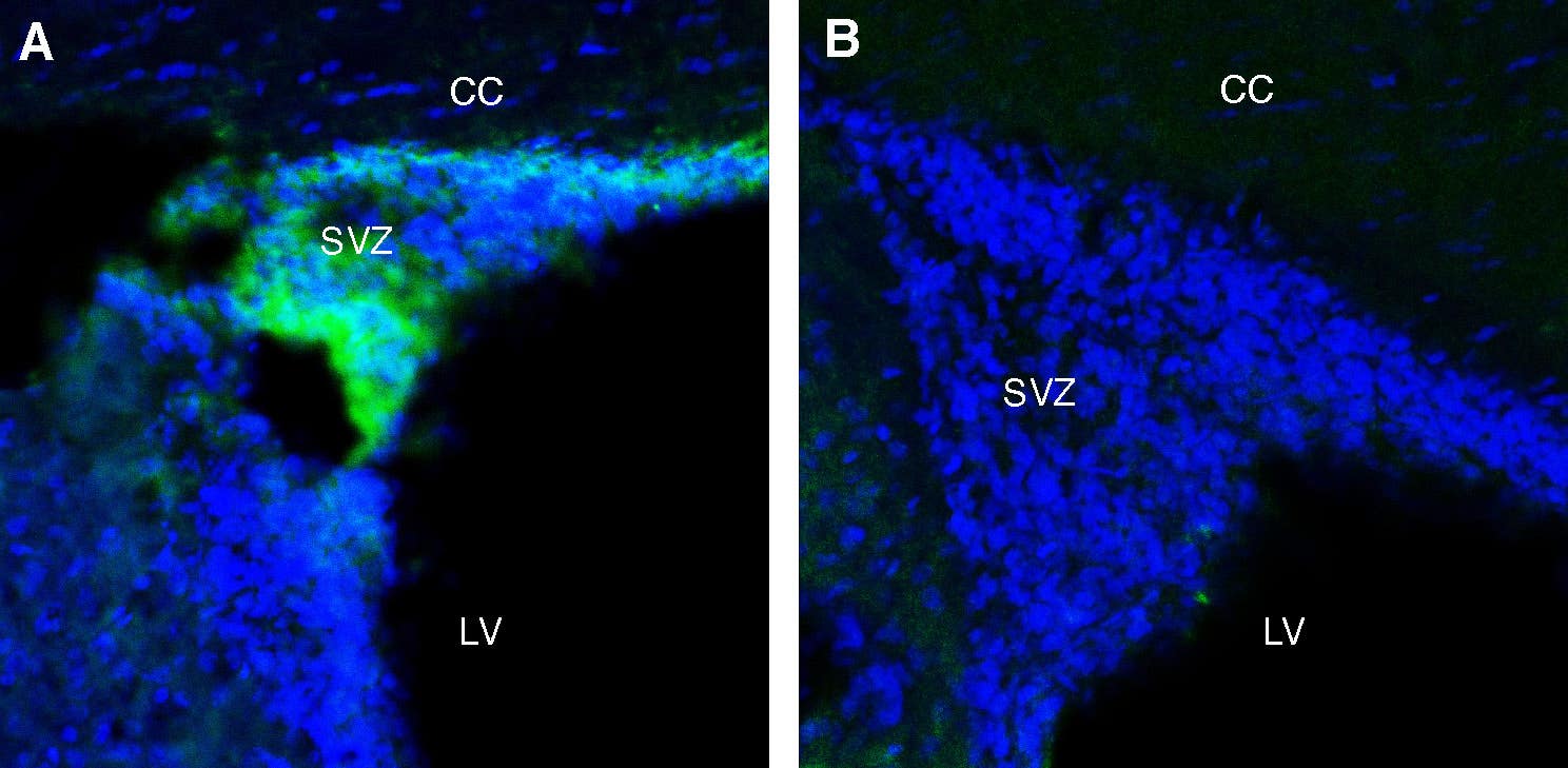 Anti-Adenosine A1 Receptor (extracellular) Antibody