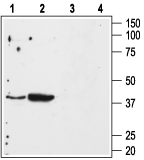 Angiotensin II Receptor Type-1 (extracellular) Blocking Peptide