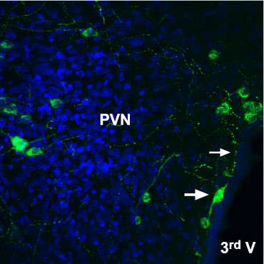 Anti-Angiotensin II Receptor Type-2 (extracellular)-ATTO Fluor-488 Antibody