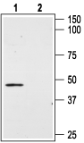 Angiotensin II Receptor Type-2 (extracellular) Blocking Peptide
