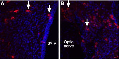 Anti-Angiotensin II Receptor Type-2 (extracellular) Antibody