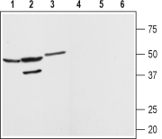 Angiotensin-(1-7) Mas Receptor Blocking Peptide