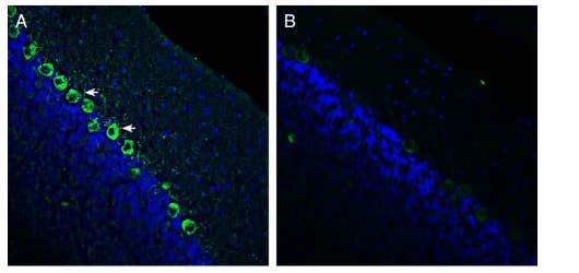 Anti-Renin Receptor/ATP6AP2 (extracellular) Antibody