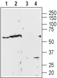 α1A-Adrenergic Receptor (extracellular) Blocking Peptide