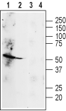 β2-Adrenergic Receptor (extracellular) Blocking Peptide