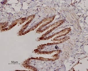 Anti-β<sub>2</sub>-Adrenergic Receptor (extracellular) Antibody