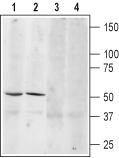 β3-Adrenergic Receptor (extracellular) Blocking Peptide