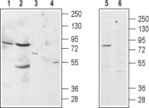 α1B-Adrenergic Receptor (extracellular) Blocking Peptide