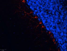 Anti-α<sub>1B</sub>-Adrenergic Receptor (extracellular) Antibody