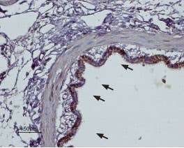 Anti-α<sub>2B</sub>-Adrenergic Receptor (extracellular) Antibody