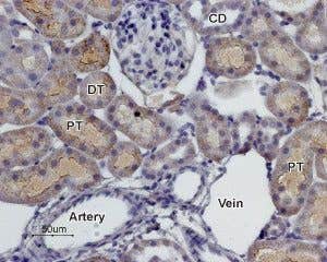 Anti-α<sub>2C</sub>-Adrenergic Receptor (extracellular) Antibody