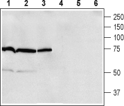 β1-Adrenergic Receptor (extracellular) Blocking Peptide