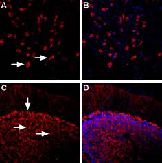 Anti-β<sub>1</sub>-Adrenergic Receptor (extracellular) Antibody