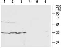 Human C5aR1 (extracellular) Blocking Peptide