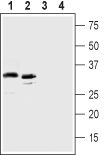 Human C5aR2 (extracellular) Blocking Peptide