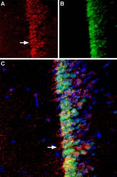Anti-Adenylate Cyclase 3 (AC3) (extracellular) Antibody